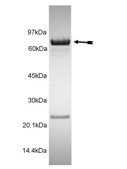 Eurofins DiscoverX CHK1 Protein, Active 10 &mu;g | Buy Online | Eurofins DiscoverX | Fisher Scientific